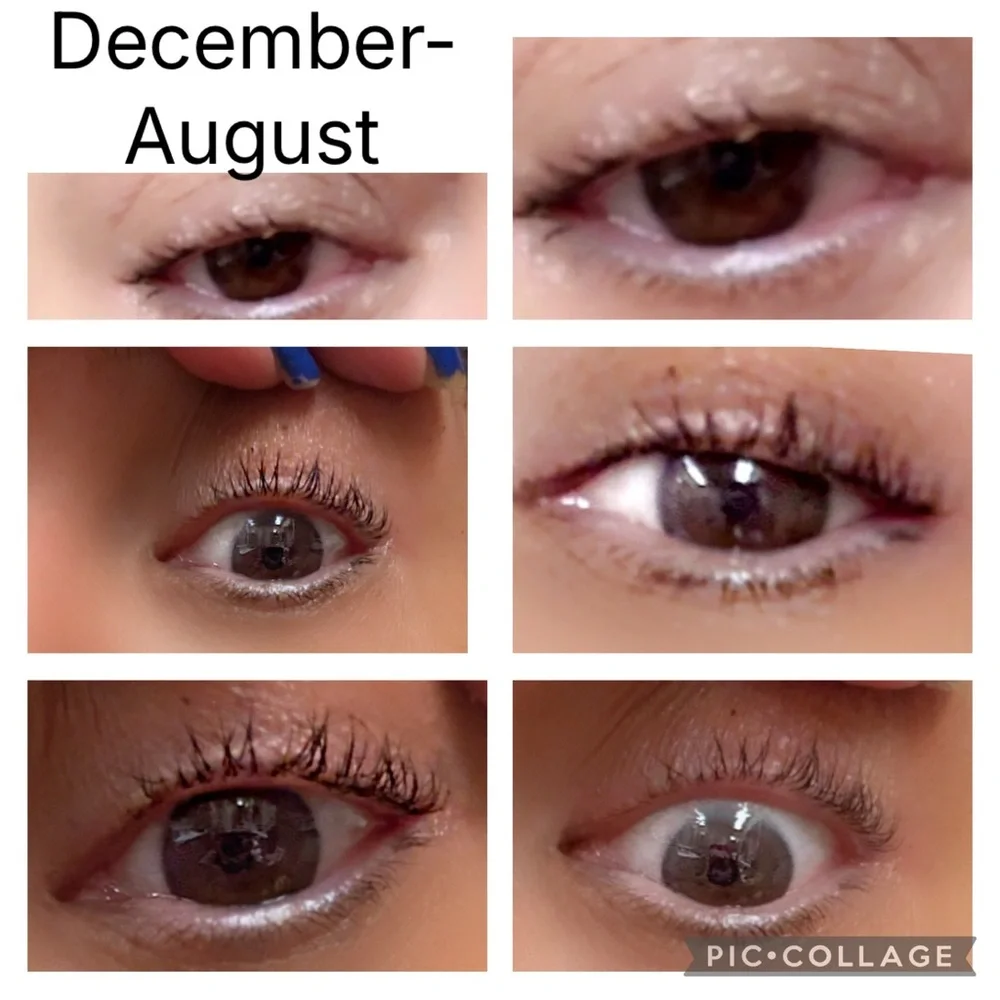 The Lash Drip